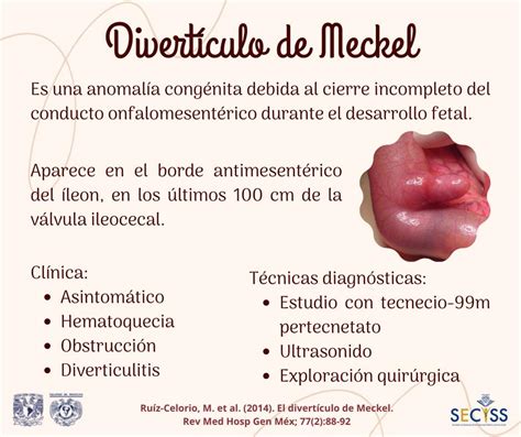 La fimosis es la anomalía congénita mas frecuente del。